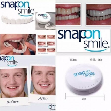 Snap-On Smile